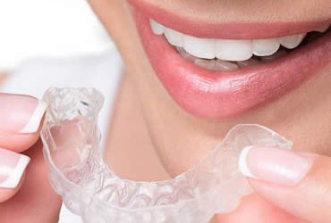 Can Invisalign Help Maintain Better Oral Health?